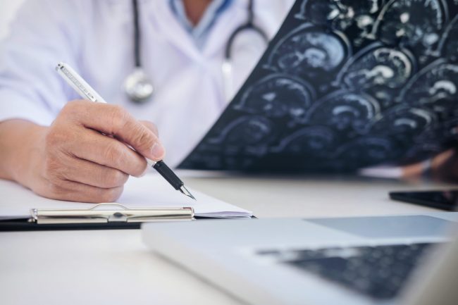 brain tumor treatment