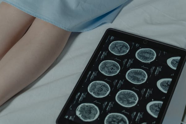 How our Neurosurgeon Puts Patients first How our Neurosurgeon Puts Patients first