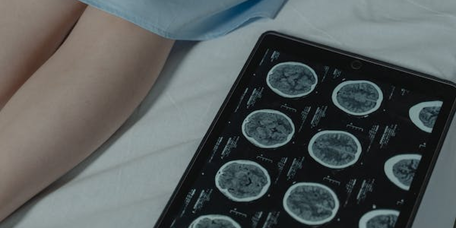 How our Neurosurgeon Puts Patients first