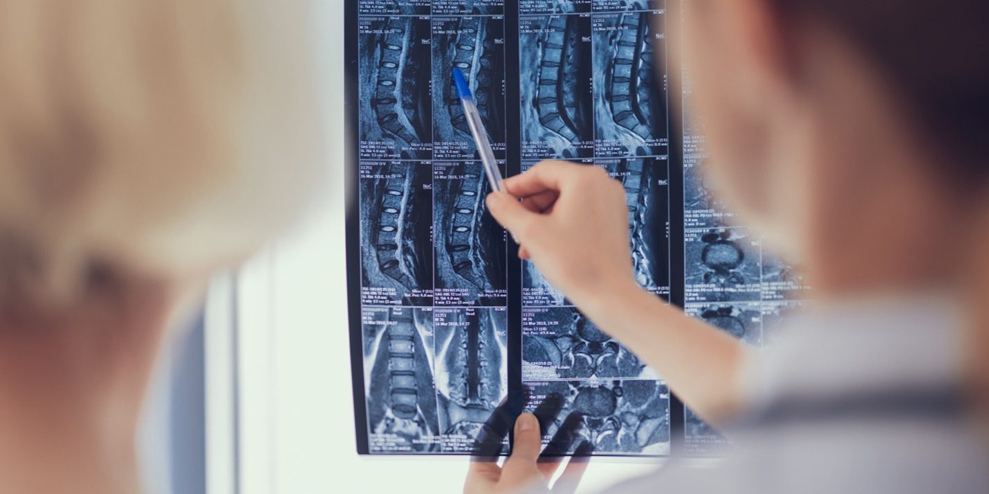 Learn More About Dr. Chris Michael, Your Go-to Spine Surgeon in Dallas