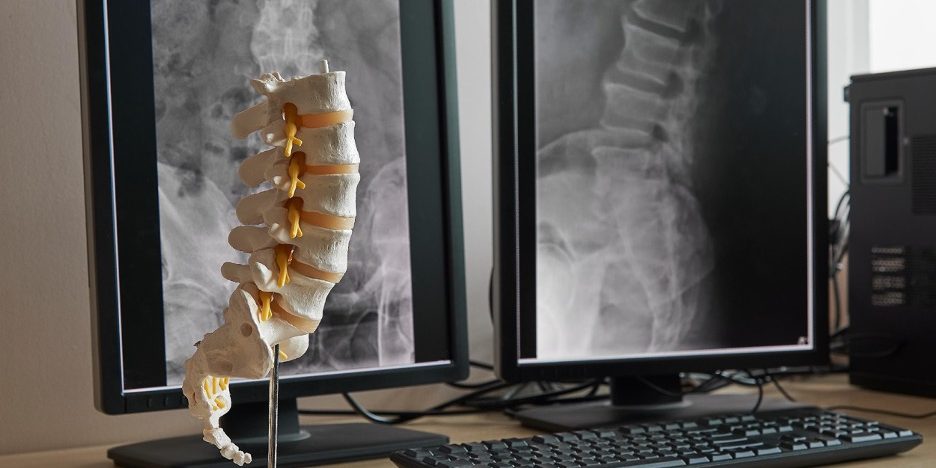 Why Dr. Chris Michael is a Top Choice Among Back Doctors in Dallas Why Dr. Chris Michael is a Top Choice Among Back Doctors in Dallas
