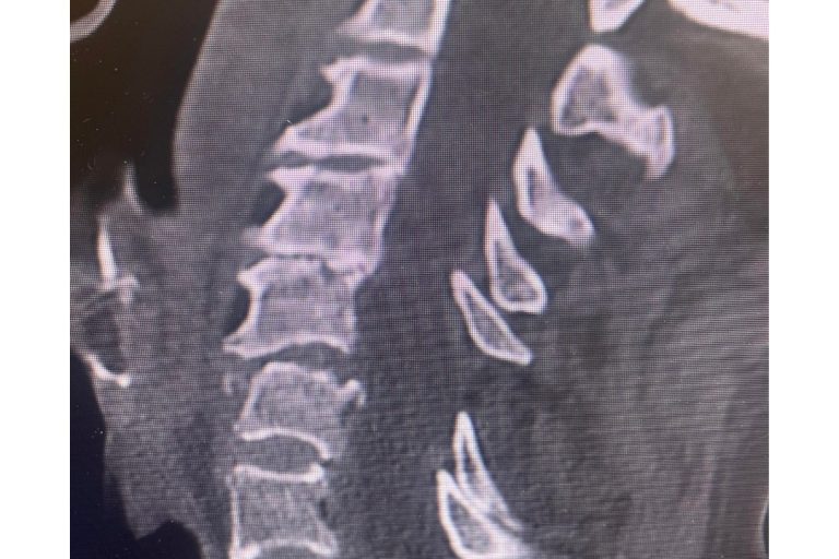 290795571_487867909765411_6516461075136189391_n