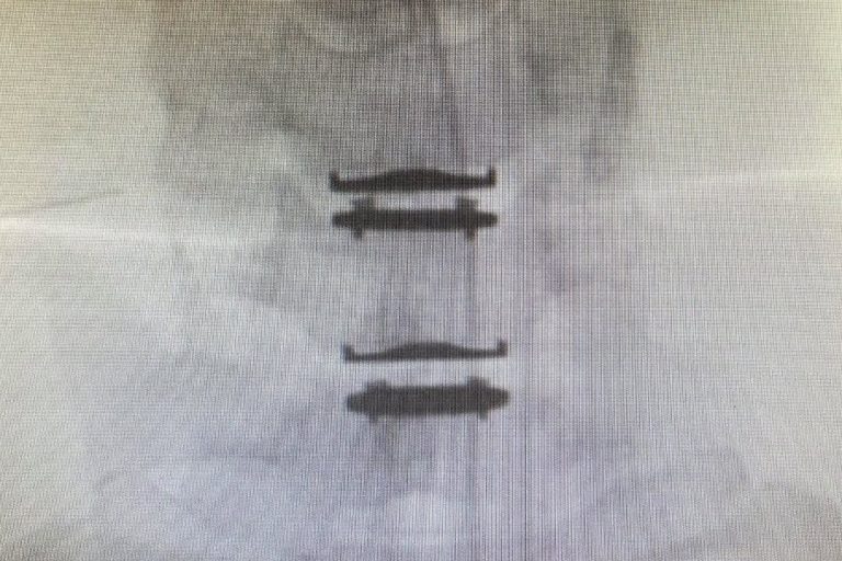 625033486_18343319011239449_7376276187529493684_n