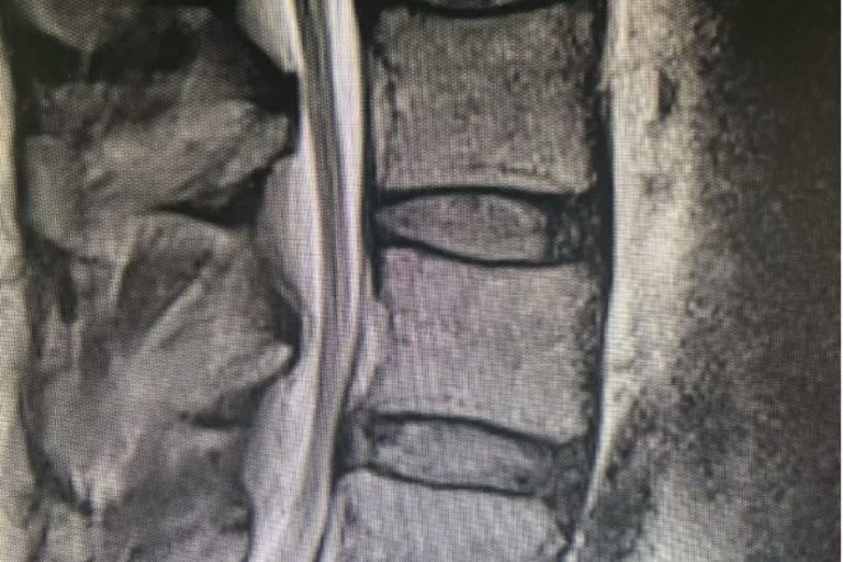 651916675_18125138905563513_3438045325227498671_n